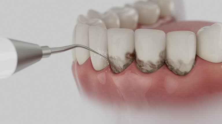 Reliable Dental contractor in Garfield, TX by Smile Center Dentistry